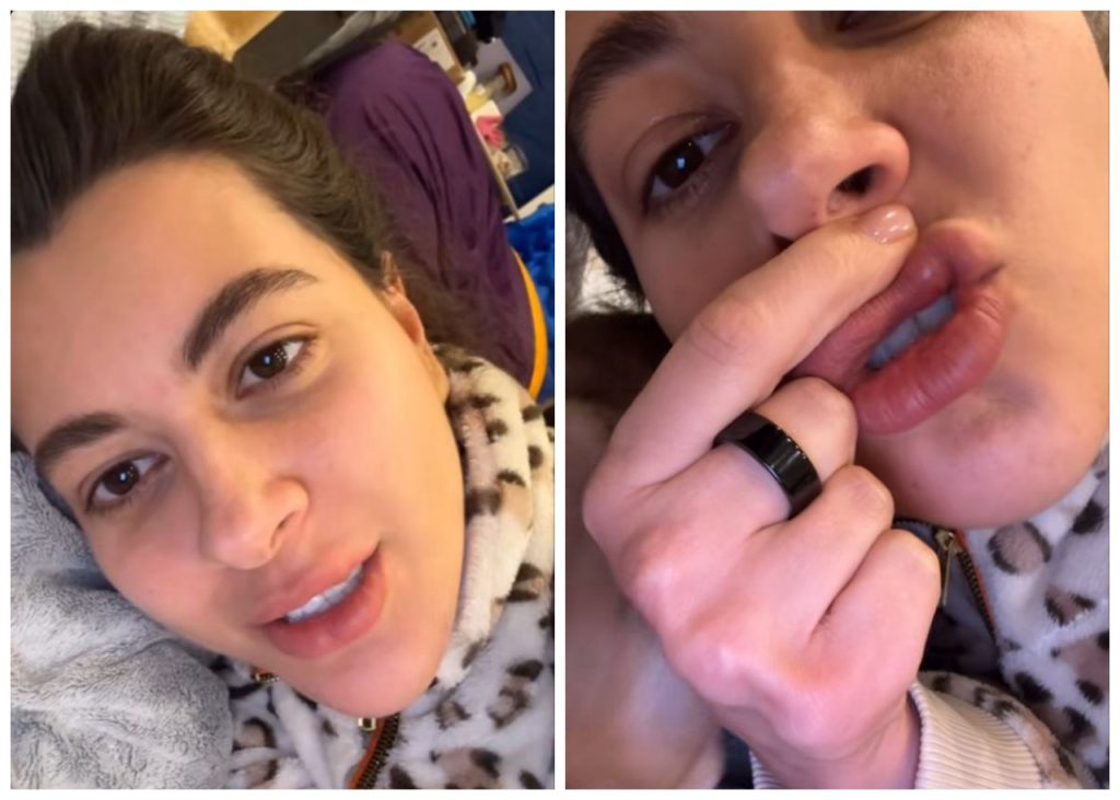 Раміна губи